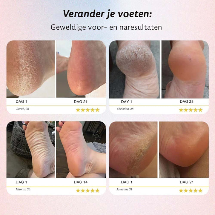 Silk Pro+ | Zachte voeten zonder dure salonbezoeken